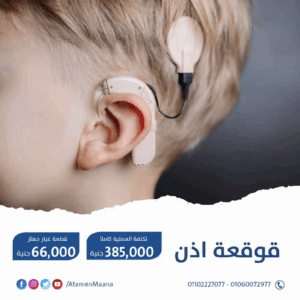 Cochlear implant